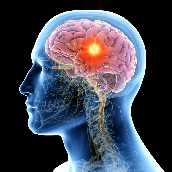 eastern healers brain treatment