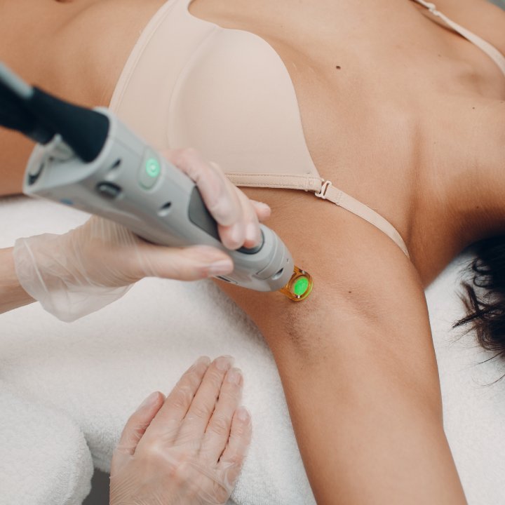 permanent hair removal panmed